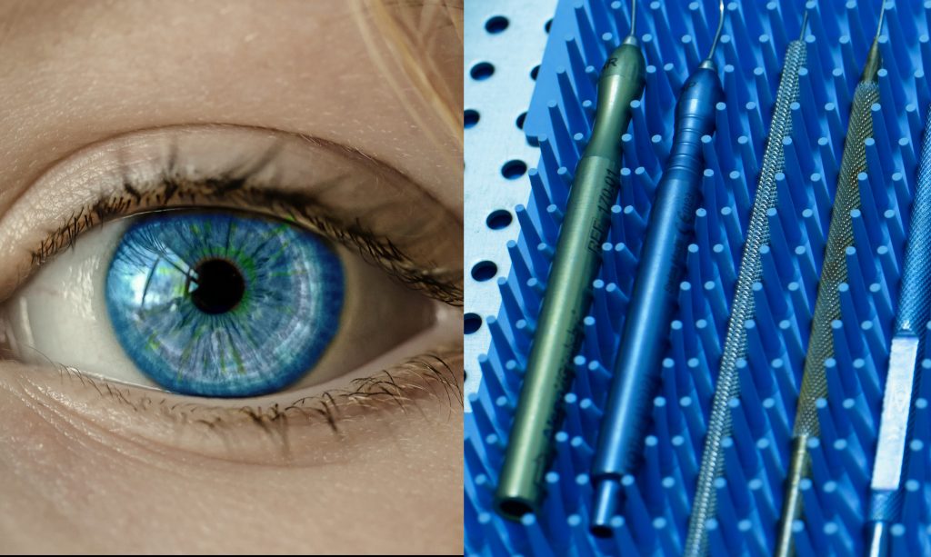 Am linken Bild ist ein Auge einer Frau erkennbar, am rechten Bild sieht man Operationsinstrumente die für eine Operation des grauen Stars erforderlich sind